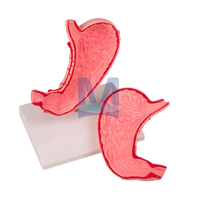 Model žaludku v životní velikosti - otevřený, 2 části