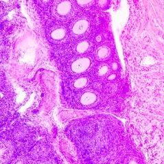 Mikroskopické preparáty – školní sada č. 4, 25 ks