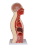 Torzo NG sondy a tracheostomie