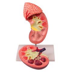 Model ledviny s nadlevinou dvakrát zvětšený, dvoudílný - rozložený